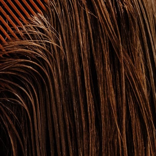 PRFM Hair Restoration at Rethink Aesthetics in Manhasset, NY